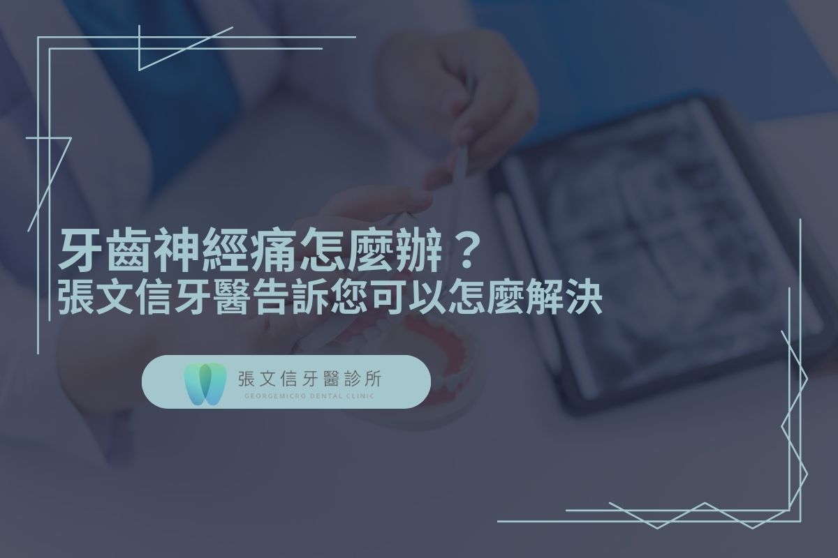 Read more about the article 牙齒神經痛怎麼辦？張文信牙醫告訴您可以怎麼解決