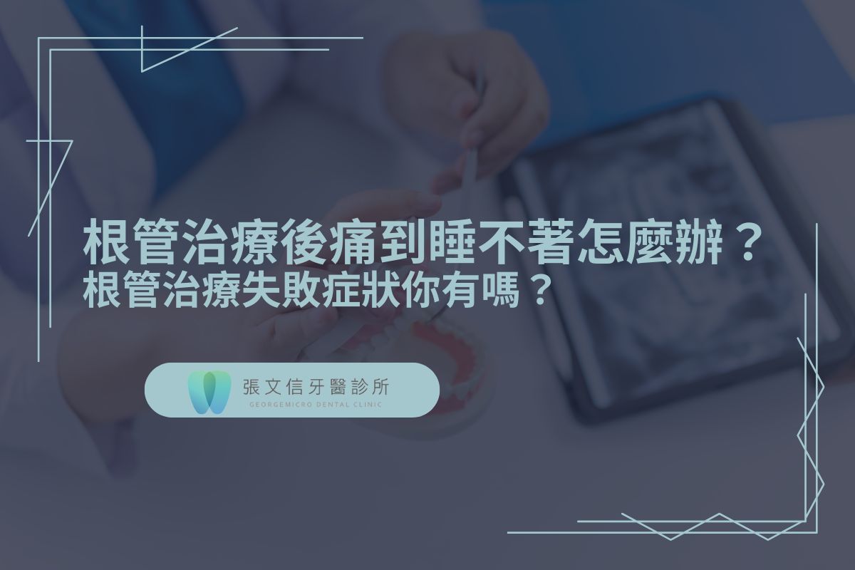 Read more about the article 根管治療後痛到睡不著怎麼辦？根管治療失敗症狀你有嗎？