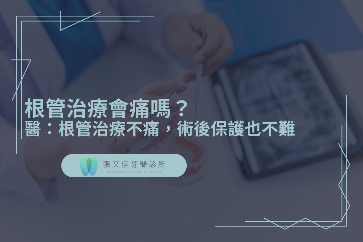 Read more about the article 根管治療會痛嗎？醫：根管治療不痛，術後保護也不難