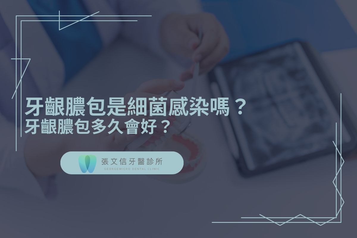 Read more about the article 牙齦膿包是細菌感染嗎？牙齦膿包多久會好？