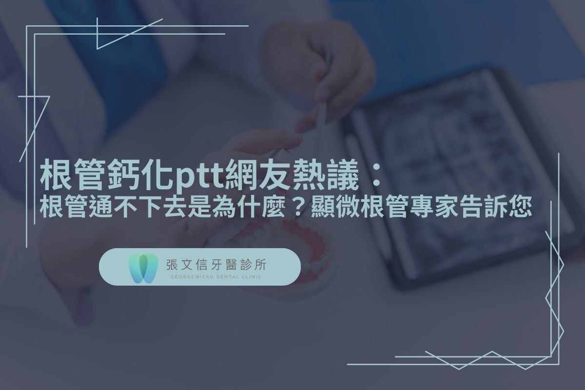 Read more about the article 根管鈣化ptt網友熱議：根管通不下去是為什麼？顯微根管專家告訴您