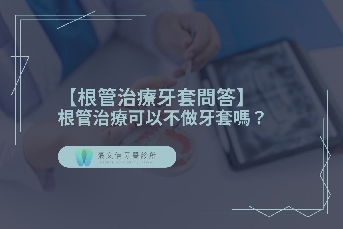 【根管治療牙套問答】根管治療可以不做牙套嗎？