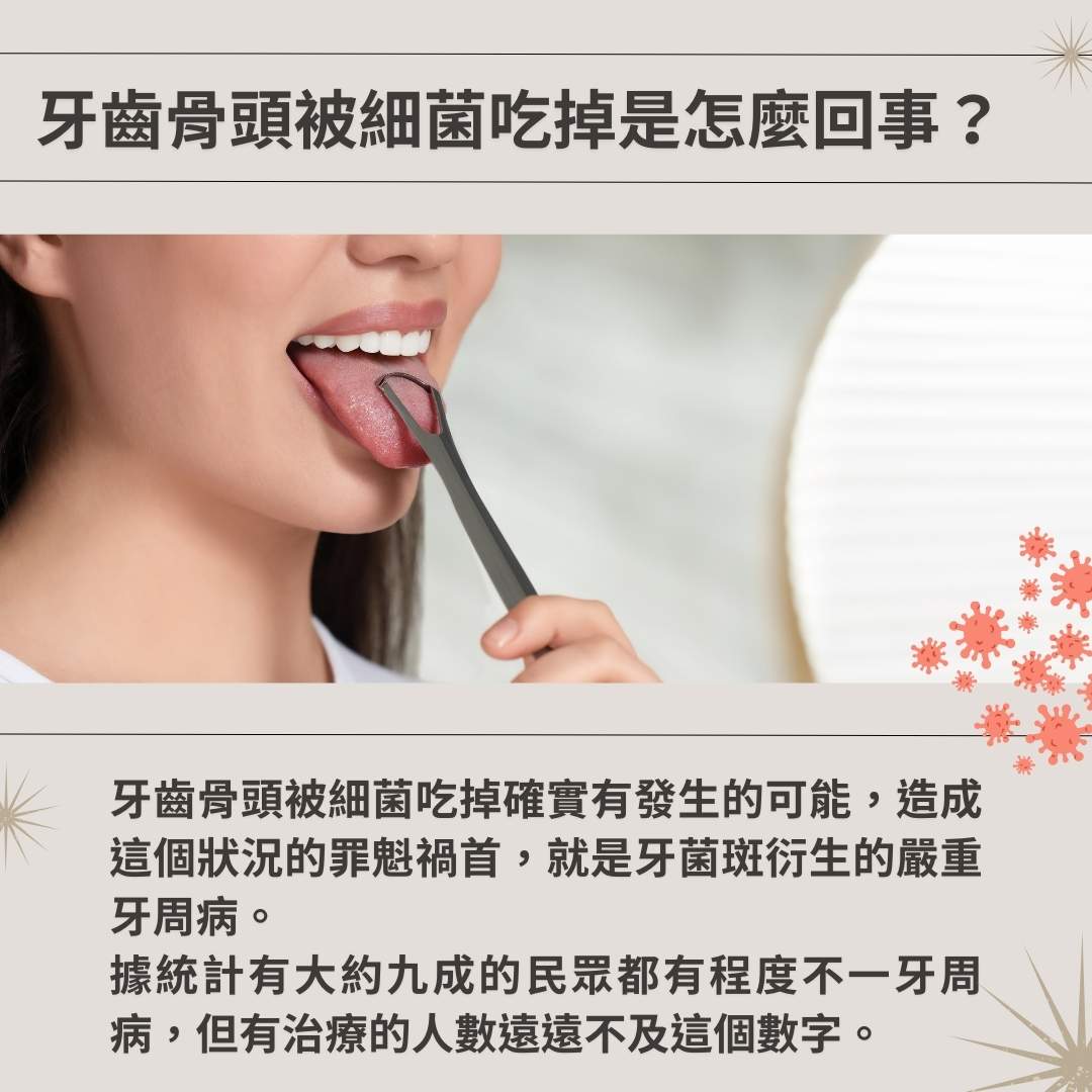 牙齒骨頭被細菌吃掉是怎麼回事